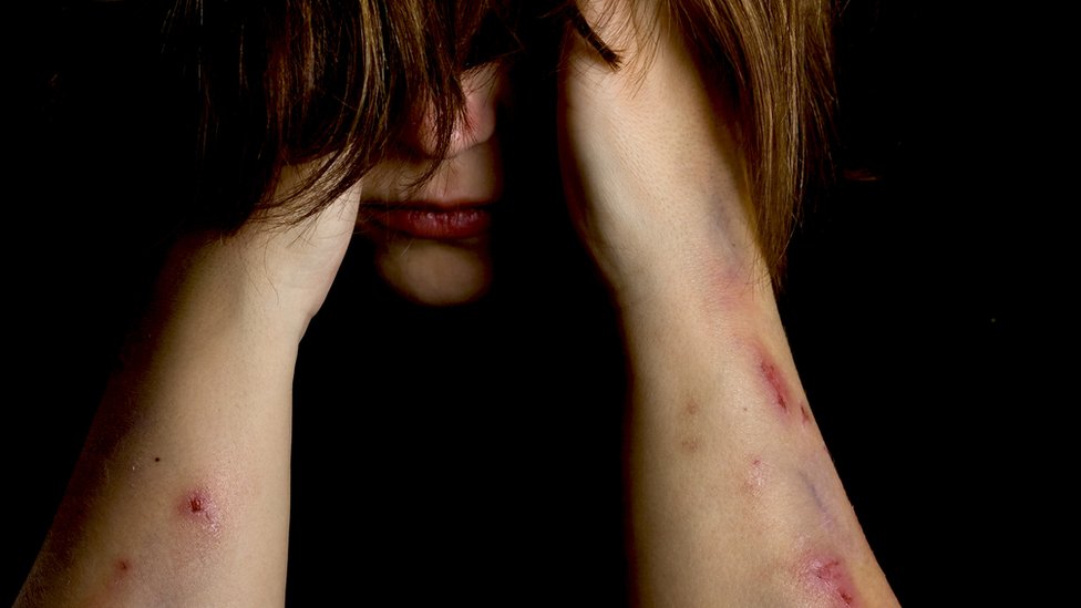 Mujer con cara oculta y heridas en los brazos.