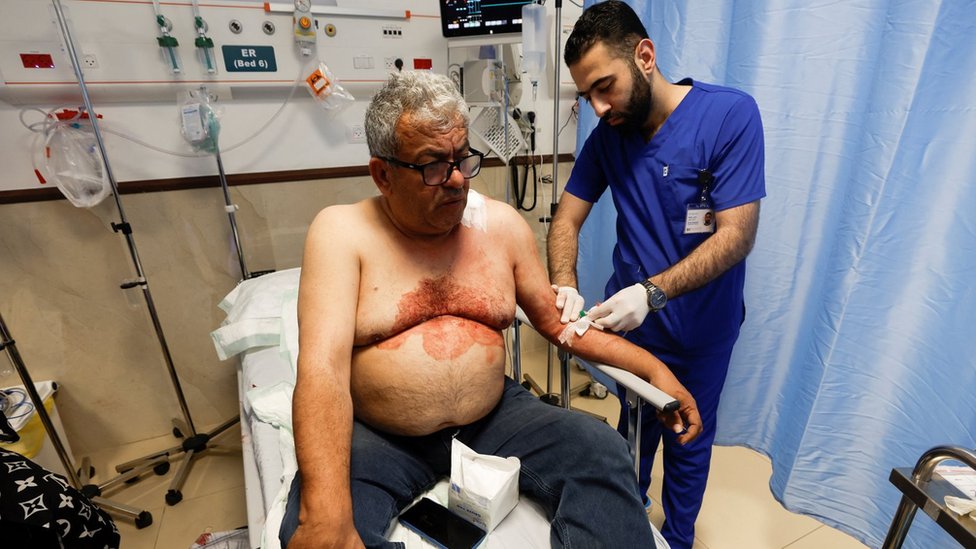 Producent Al Džazire Ali Samoudi, koji je ranjen, rekao je da su izraelski vojnici prvi pucali