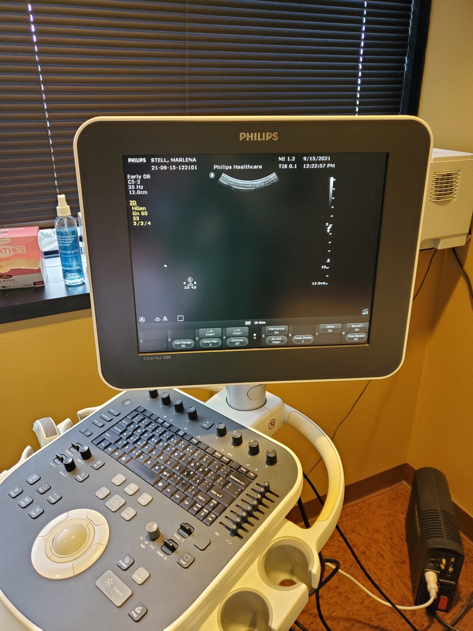 El monitor que le mostró su embarazo anembrionario.