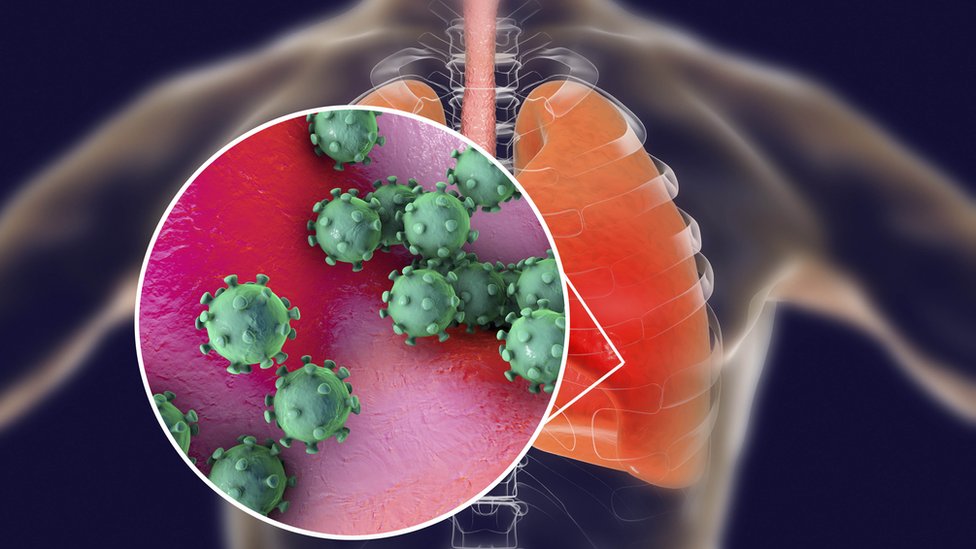 Virus in the lung