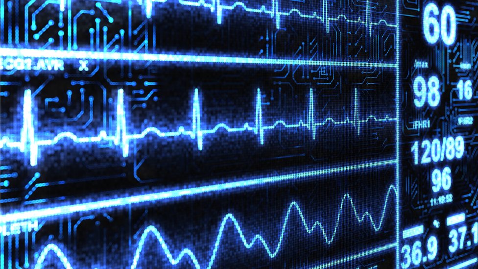Imagen de monitor de frecuencia cardiaca y cerebral