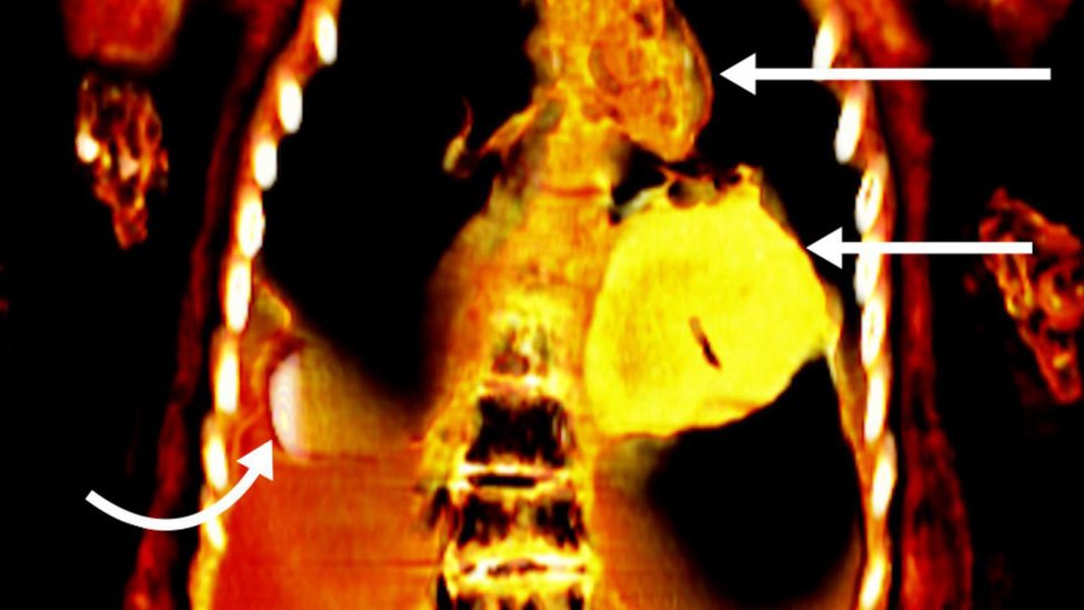 Image showing the mummy's golden heart