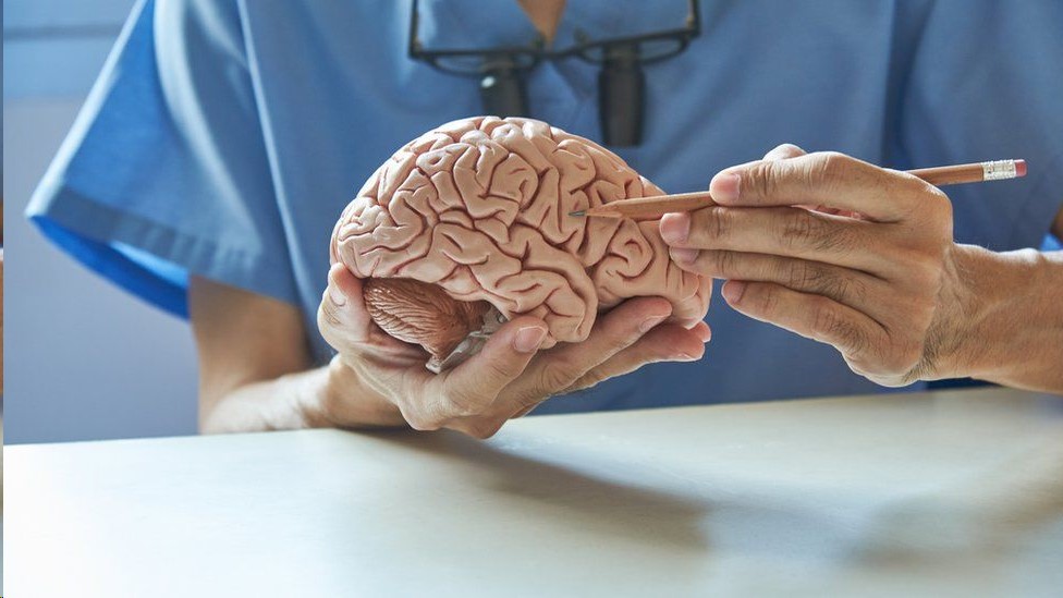 Un médico sosteniendo un cerebro