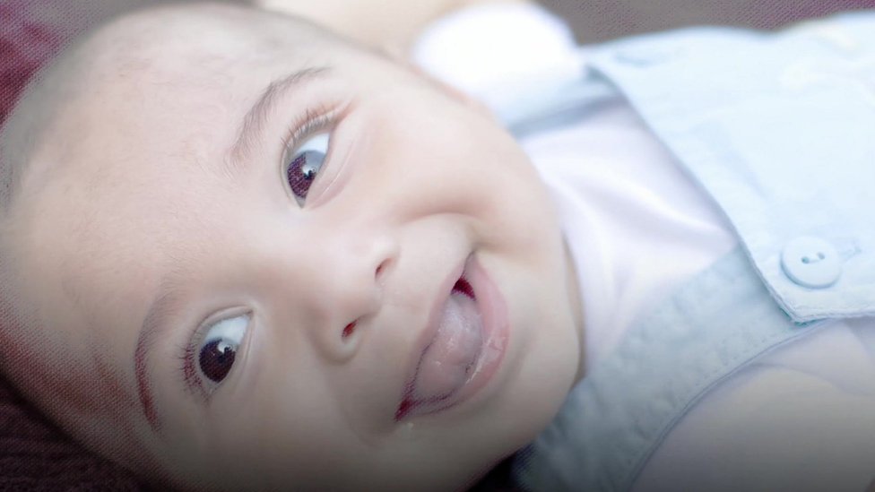 Durante los primeros meses de vida, Elaan lucía como un bebé normal, pero le fue diagnosticada una parálisis en varias partes de su cerebro. Elaan