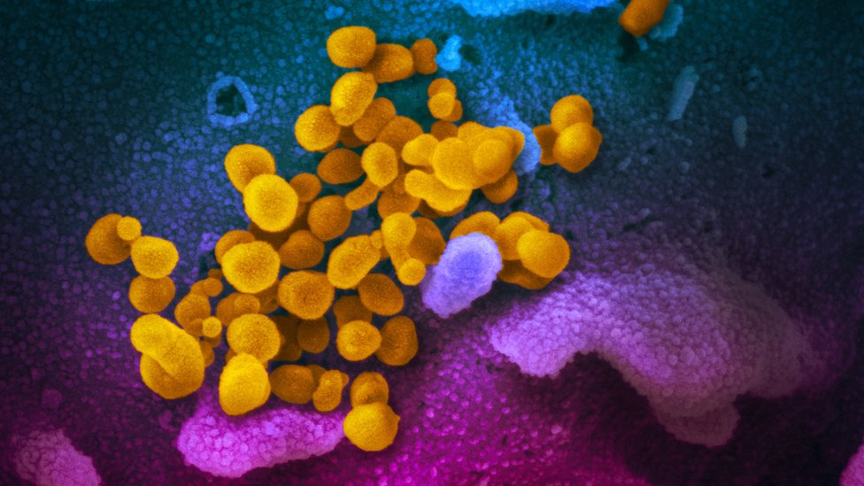 coronavirus
