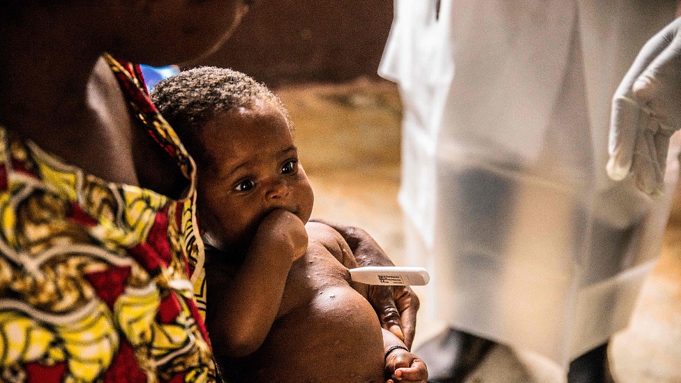 Un bebé y su madre infectados aguardan a ser atendidos por viruela del mono en la República Centroafricana.