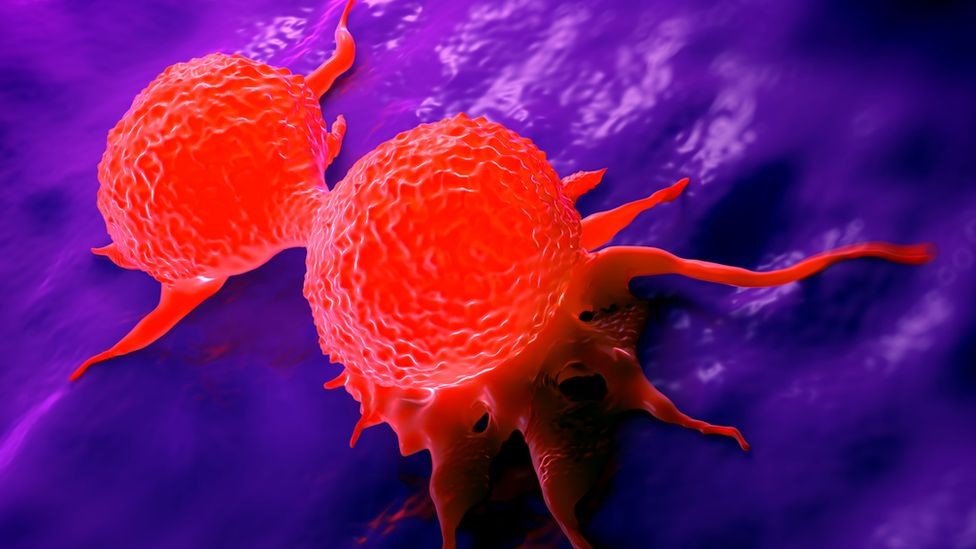 رسم توضيحي للسرطان.