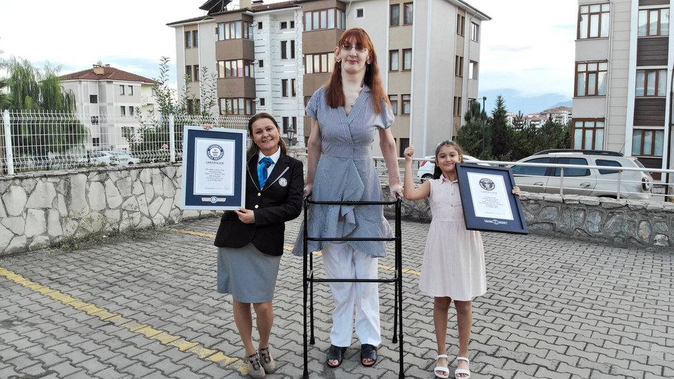 Rumeysa Gelgi recibe el reconocimiento como la mujer viva más alta del mundo