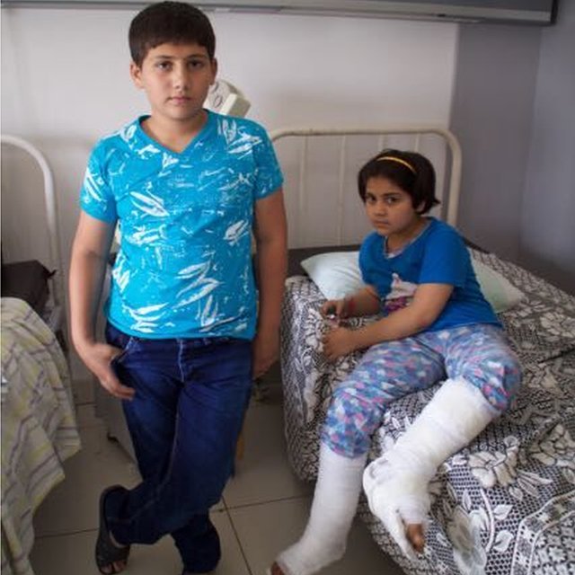 14-летний Мохаммад Амер и 9-летний Маяр потеряли мать и младшего брата в результате минометного обстрела, сентябрь 2016 г.