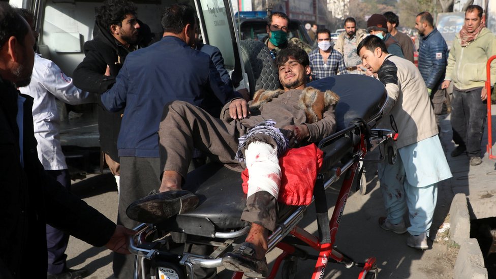 Раненого доставили в больницу после попадания ракет в жилые районы Кабула