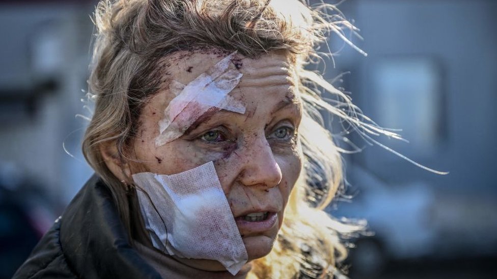 Mujer herida en Chuguiv, Ucrania.
