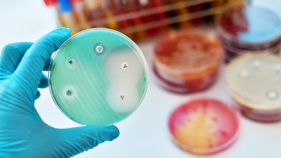 Millions are dying from drug-resistant infections, global report says