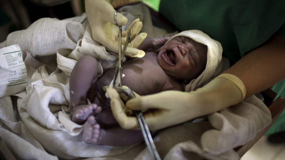 Bebê chorando enquanto médico corta cordão umbilical