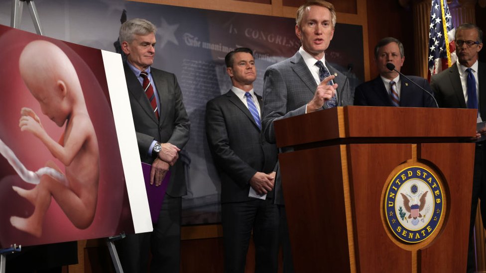 Cumhuriyetçi senatörler kürtajın sınırlanması amaçlı bir basın toplantısında