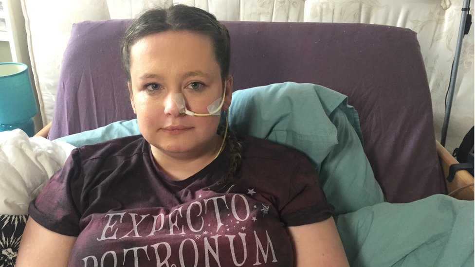 Žena koja je amputirala nogu sada kaže da joj je druga paralizovana