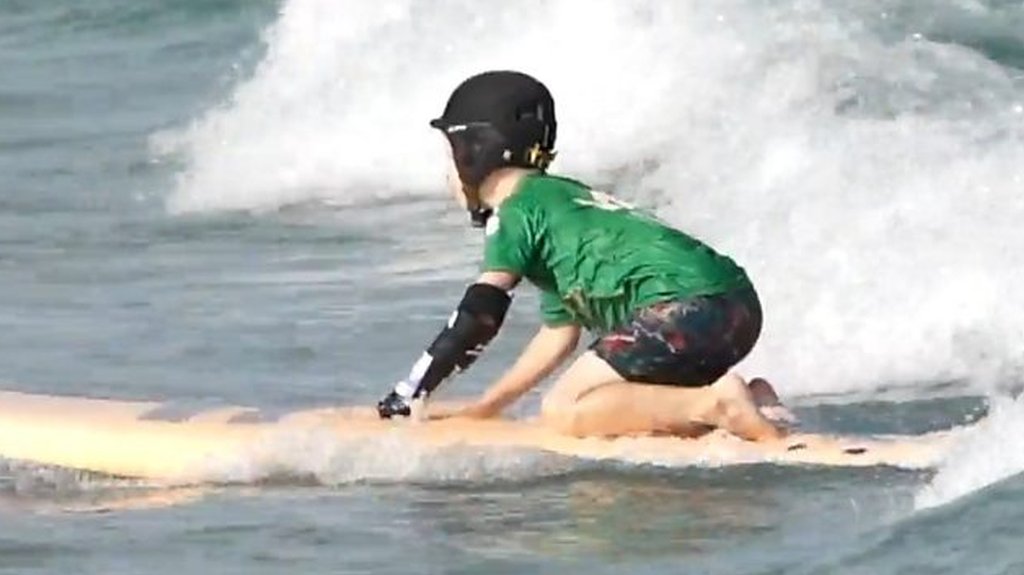 New prosthetic arm surfing aid tested in Bristol