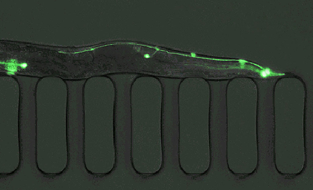 C. elegans atrapado dentro de una micrografía de luz fluorescente de laboratorio en un chip, una tecnología creada en MIT para clasificar, cribar y manipularlos a alta velocidad y gran volumen.