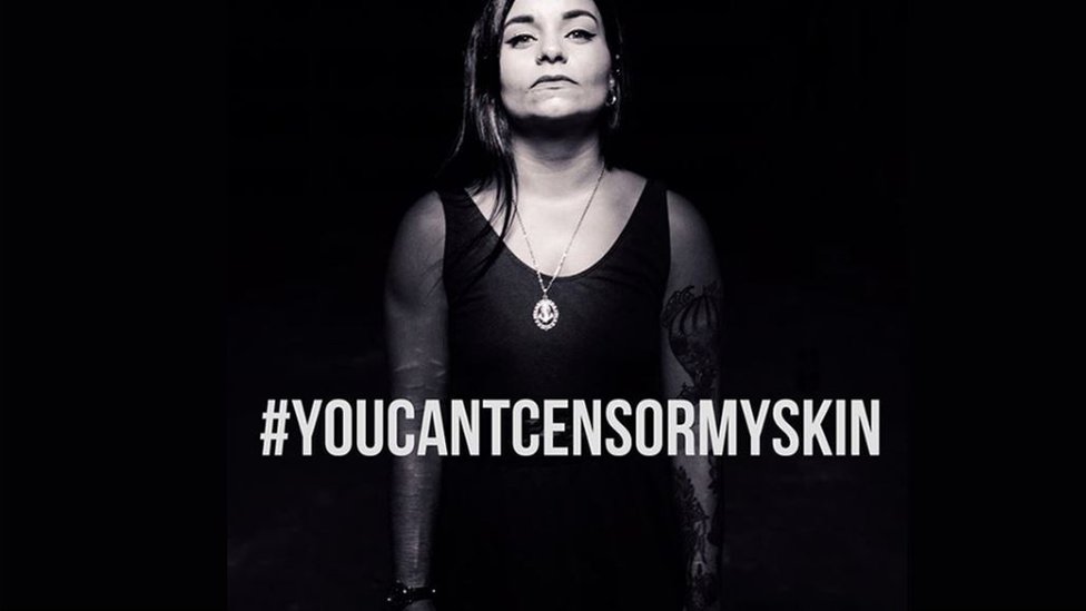 Женщина со шрамами на руках стоит за хэштегом #youcantcensormyskin