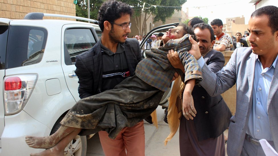 مقتل وإصابة عشرات الأطفال في غارة للتحالف بقيادة السعودية على صعدة