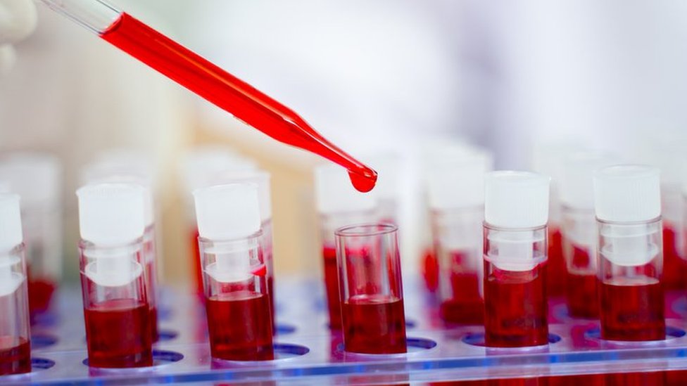 Muestras de sangre en un laboratorio