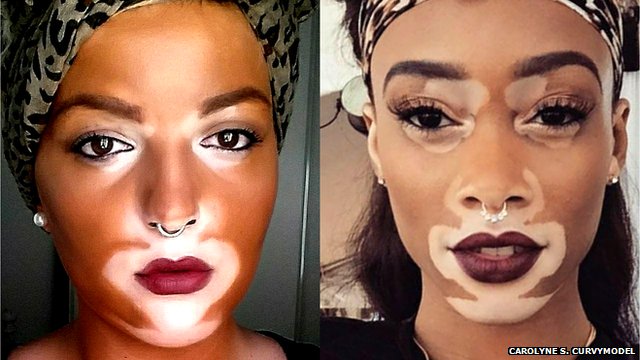 White lady wearing makeup to look like model Winnie Harlow who has vitiligo (also pictured)