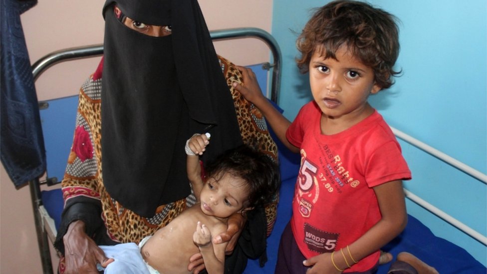 Женщина и дети в больнице в Хохе, Йемен (архивная фотография)