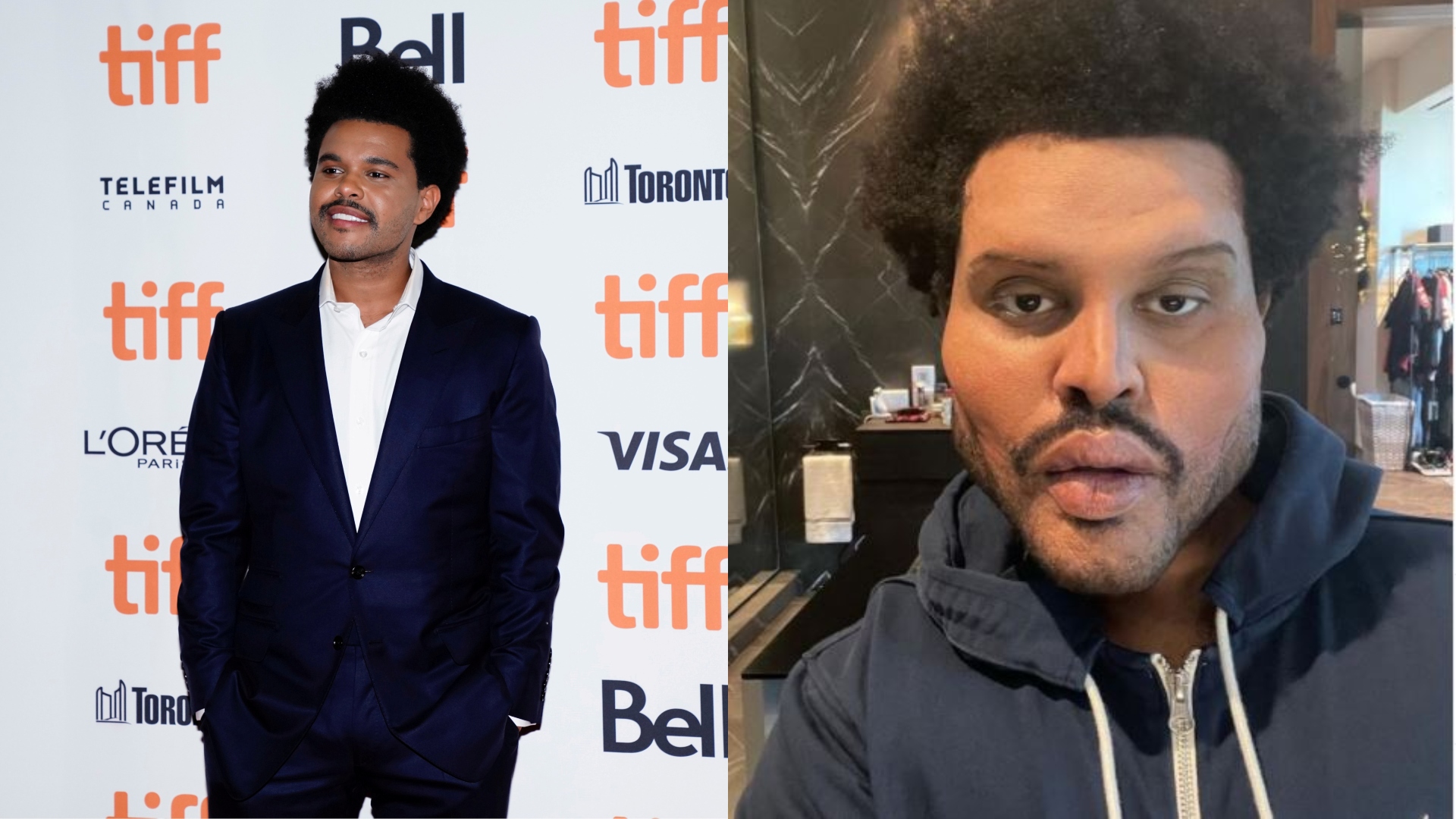 The Weeknd S Face Is That What He Really Looks Like - vrogue.co