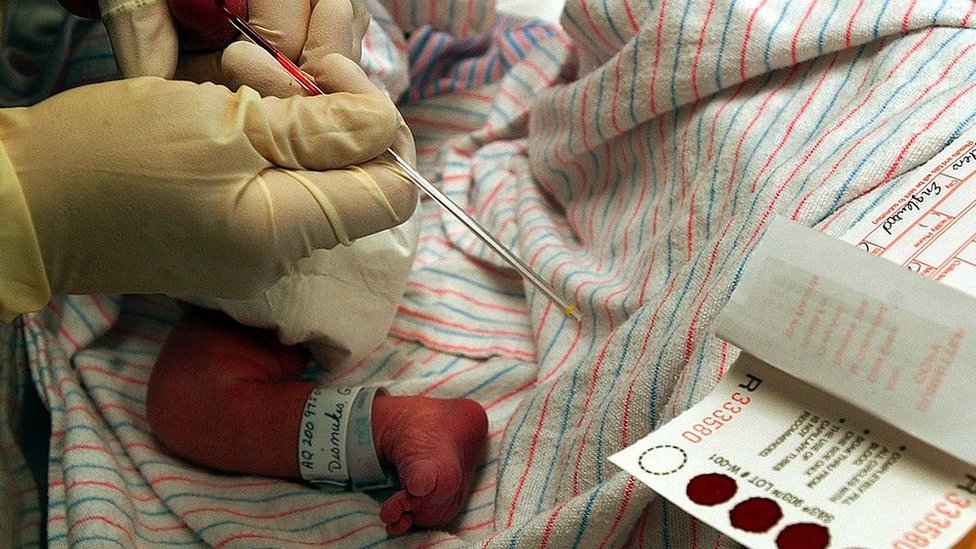 Qué es el tamizaje neonatal que Colombia obliga a realizar ahora en  hospitales públicos y privados - BBC News Mundo