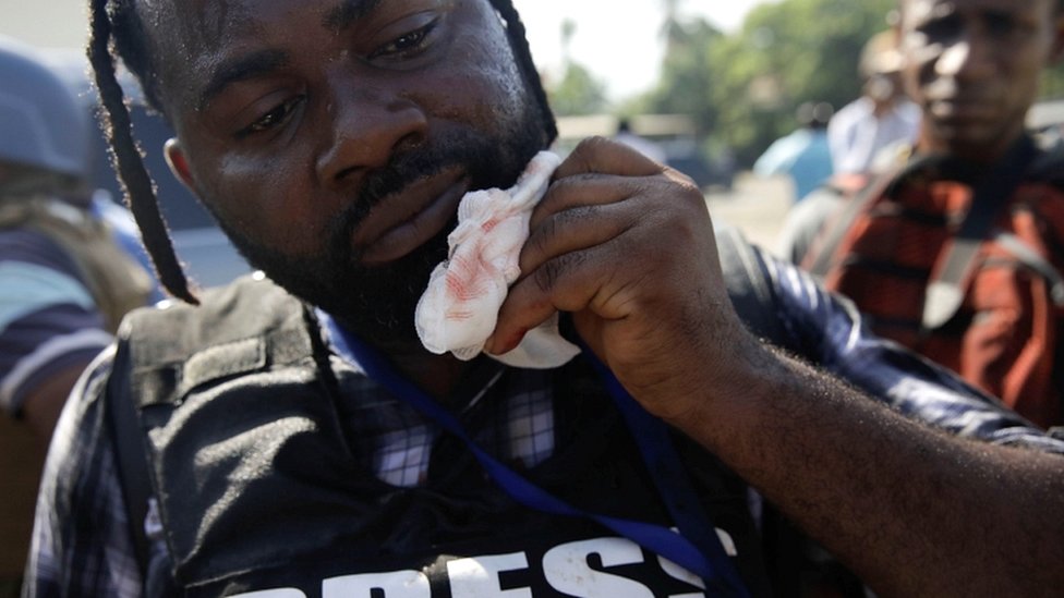 Фотокорреспондент Дьё Налио-Чери держит марлю возле рта в Порт-о-Пренсе, Гаити