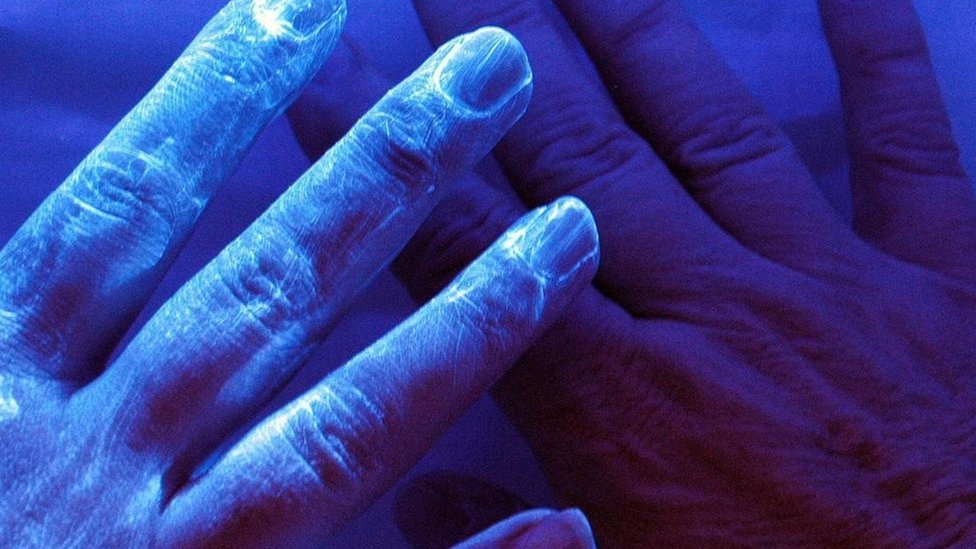 Unas manos vistas con luz ultravioleta
