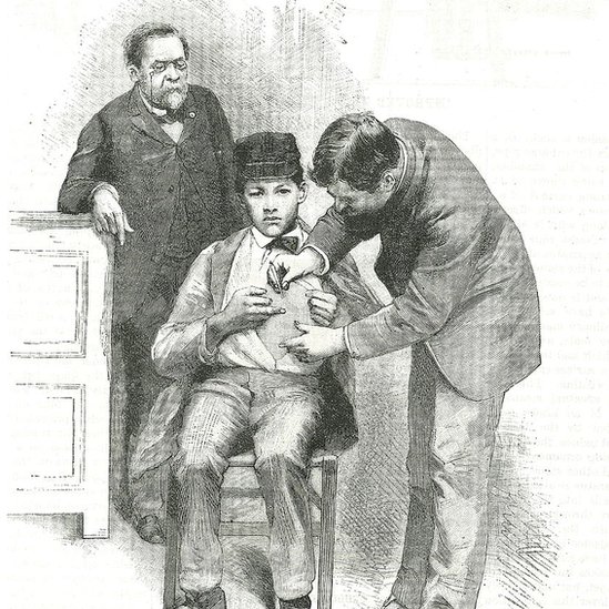 Louis Pasteur leaning on a cabinet while his male assistant injects a young man's stomach