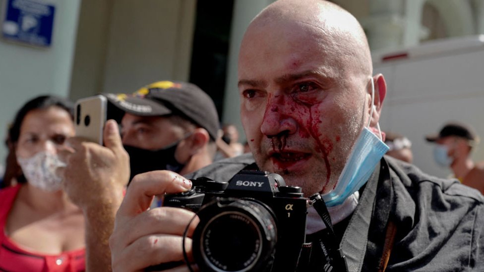 Fotógrafo cubano golpeado durante las protestas.
