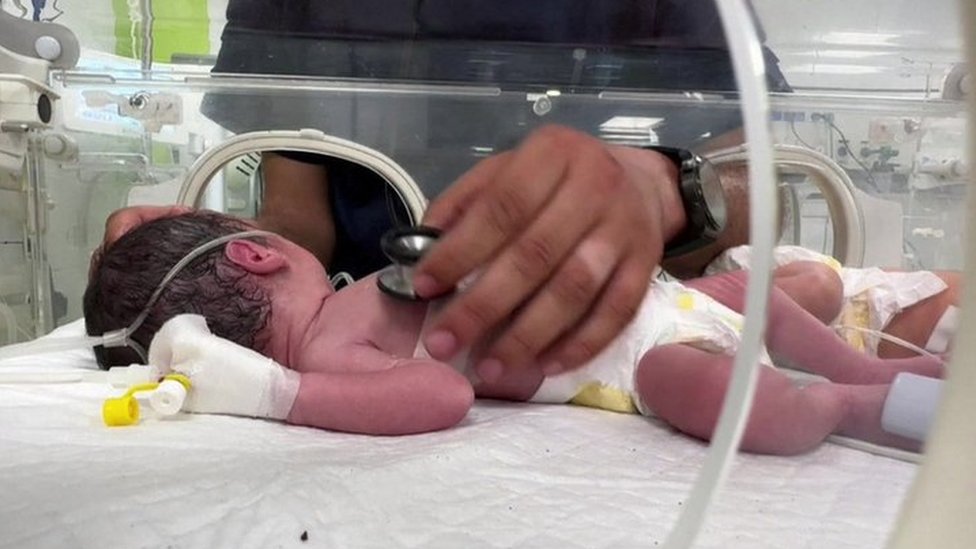 Israel-Gaza: Baby saved from dead mothers womb after Israeli strike