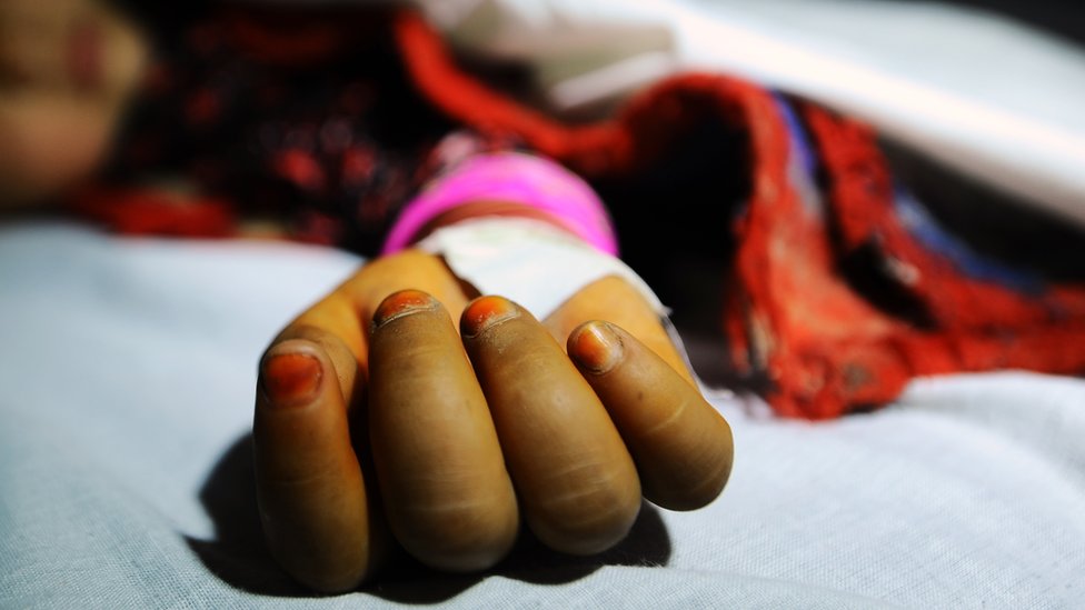 Девушка, якобы изнасилованная мужчиной, лежит на больничной койке