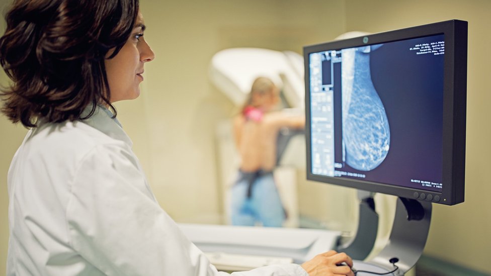 Mammogram