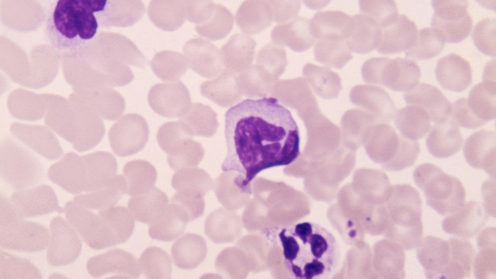 Linfocitos circulando en la sangre