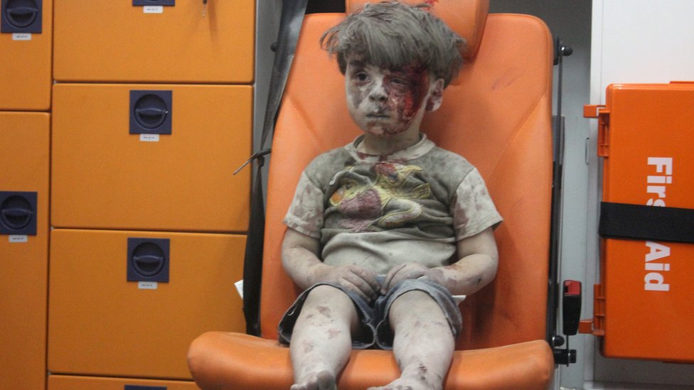 Омран Дакниш, четырехлетний сирийский мальчик, покрытый пылью и кровью, сидит в машине скорой помощи после того, как его спасли из-под обломков здания, пострадавшего от авиаудара в удерживаемом повстанцами районе Катерджи северного сирийского города Алеппо поздно вечером 17 августа 201 г.