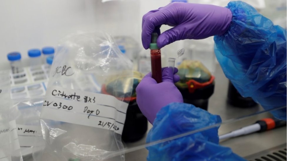 Образцы крови пациентов, инфицированных коронавирусом (COVID-19), готовятся для анализа в лаборатории обработки крови в Кембридже