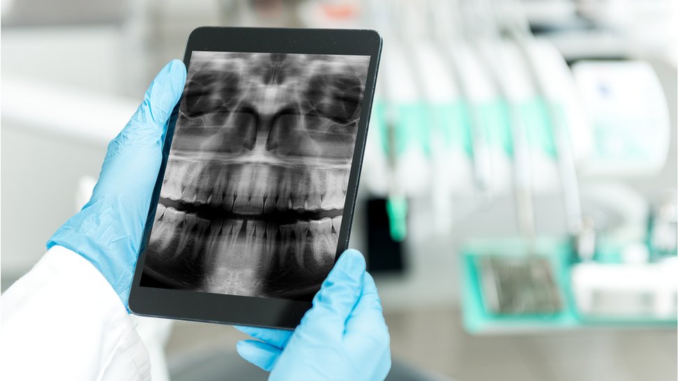 Рентген зубов и рта в синих хирургических перчатках