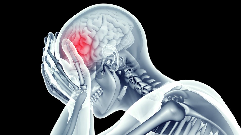 Imagen en rayos X del esqueleto mostrando dolor en el cráneo.