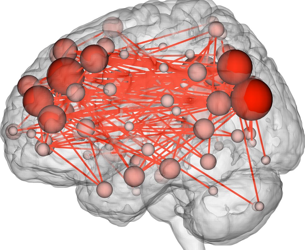 иллюстрация карты связи мозга
