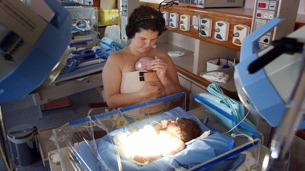 A woman looking at a baby in an incubator