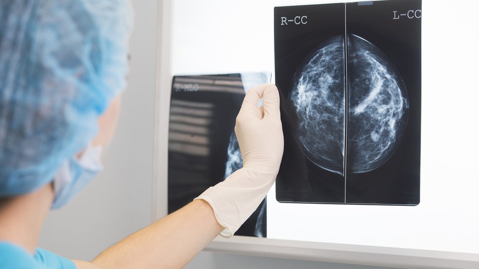 Врач показывает маммографию перед рентгеновским осветителем