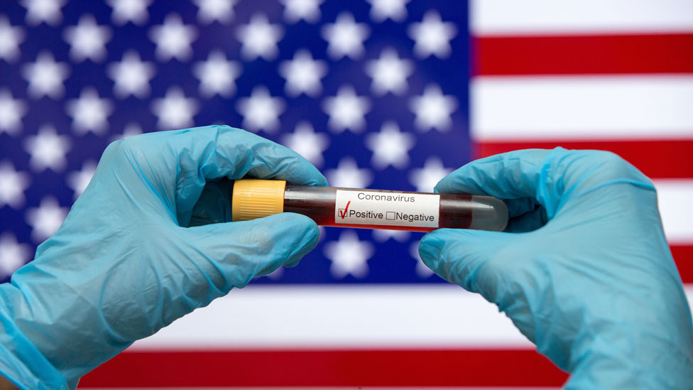 Una muestra de sangre que es positiva para coronavirus, con la bandera de EE.UU. de fondo