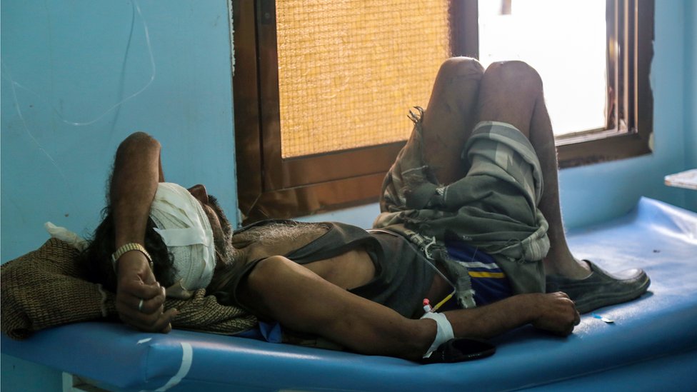 Йеменский мужчина лежит на больничной койке после того, как он, как сообщается, был ранен в результате воздушного удара коалиции под руководством Саудовской Аравии по шиитским повстанцам-хути и их союзникам 29 декабря 2015 г.