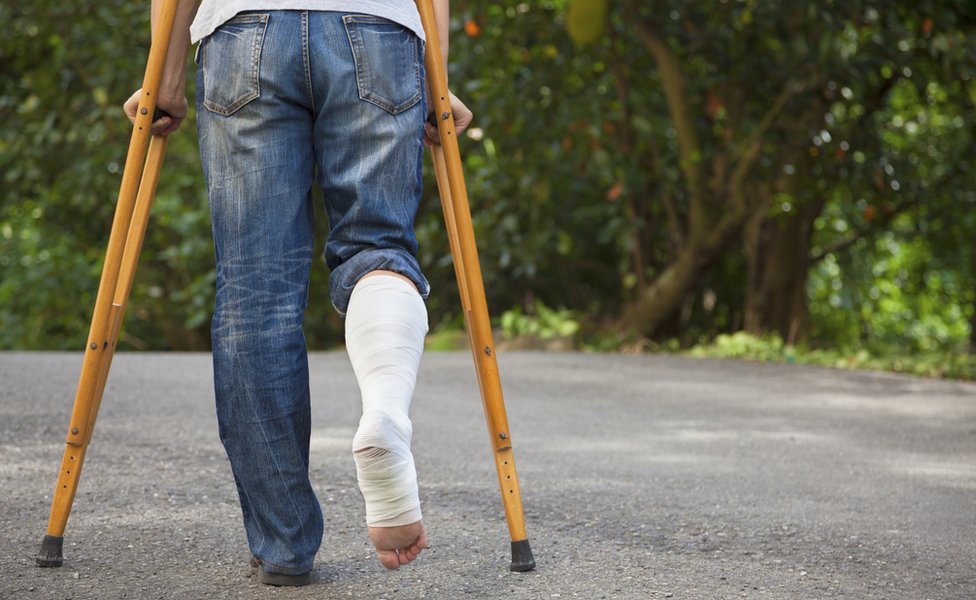 Patients asked to return crutches to Southmead Hospital A&E - BBC News