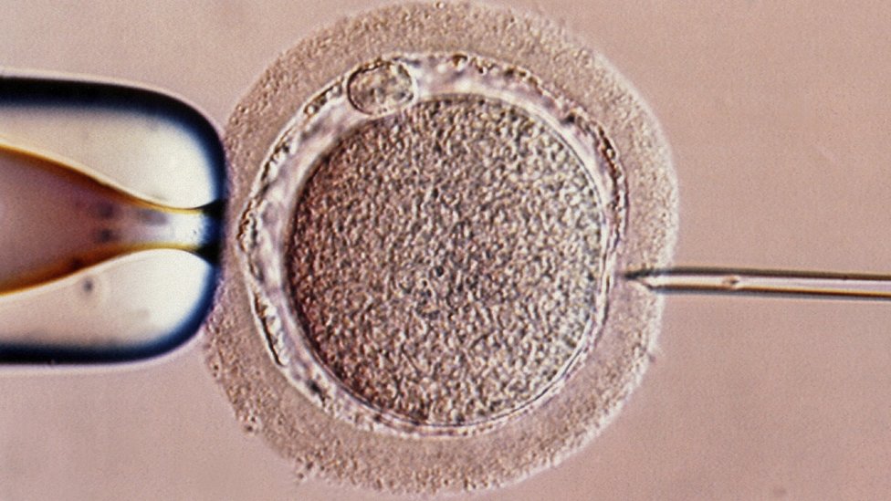 Imagen fecundación in vitro.