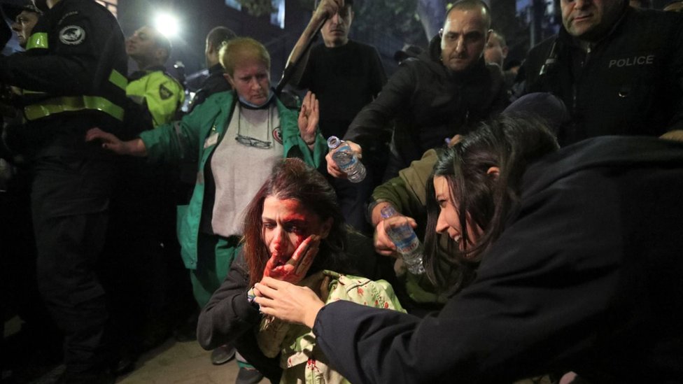 Женщина ранена во время акции протеста против ЛГБТК в Грузии в ноябре