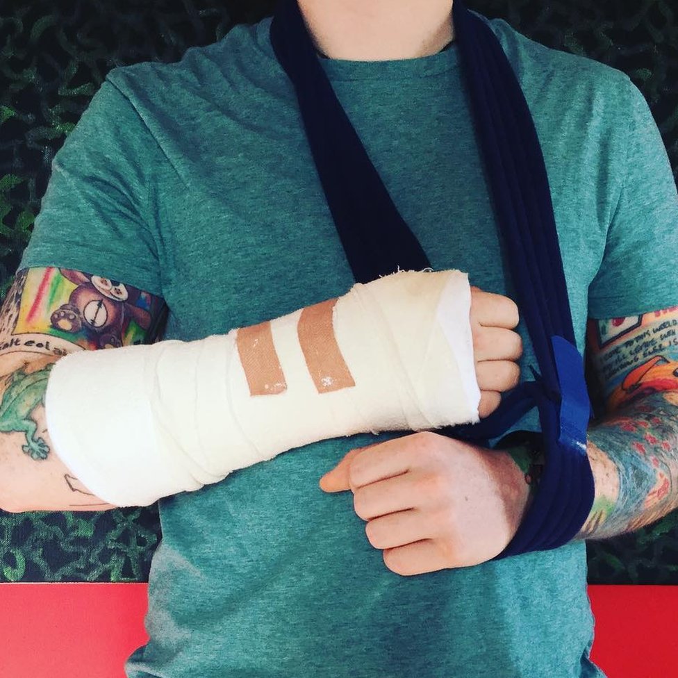 Ed Sheeran Cancels Asia Tour Dates After Cycling Accident Bbc News