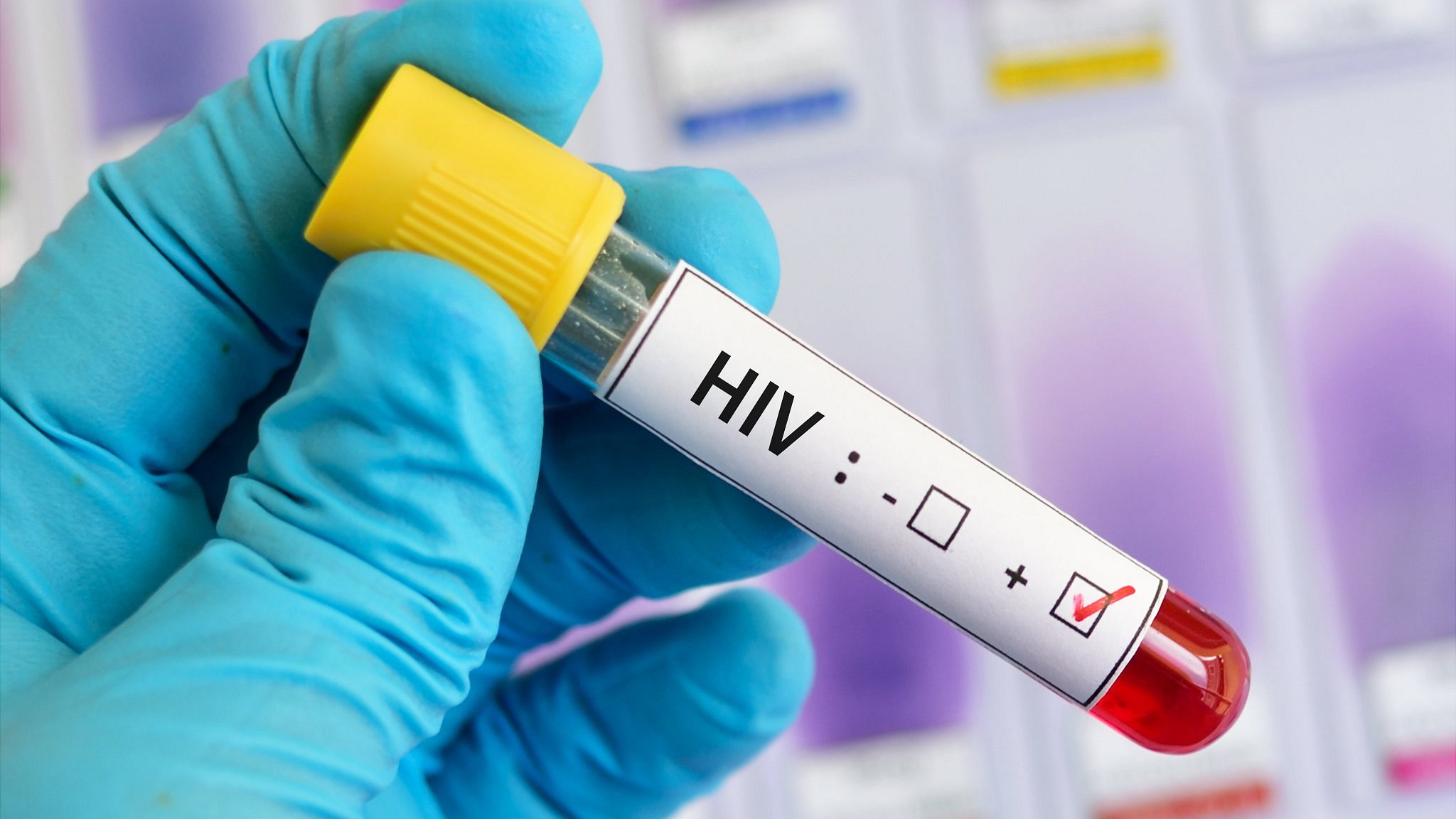 HIV infections among gay and bi men fall by 71% in UK picture